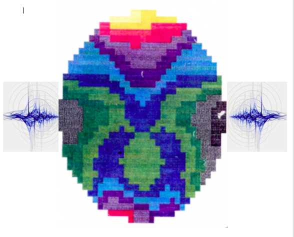 Illustration of your brain when listening to binaural beats